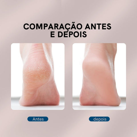 Lixadeira Elétrica para os Pés